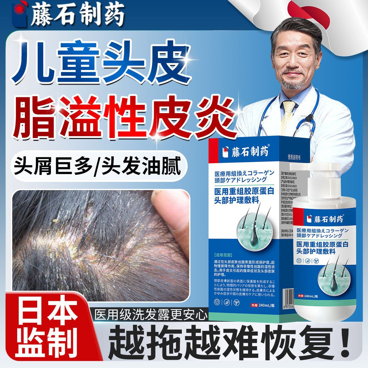 儿童脂溢性皮炎头皮屑头癣止痒专用洗发水头上真菌感染马拉色菌CB