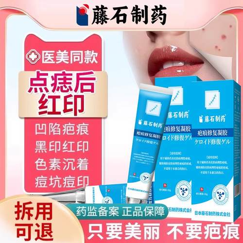 祛痣激光斑术后点疤膏去红