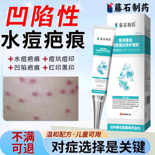 凹陷性水痘疤痕却去水痘坑痘坑痘印生长因子修复凹陷除疤膏儿童VQ