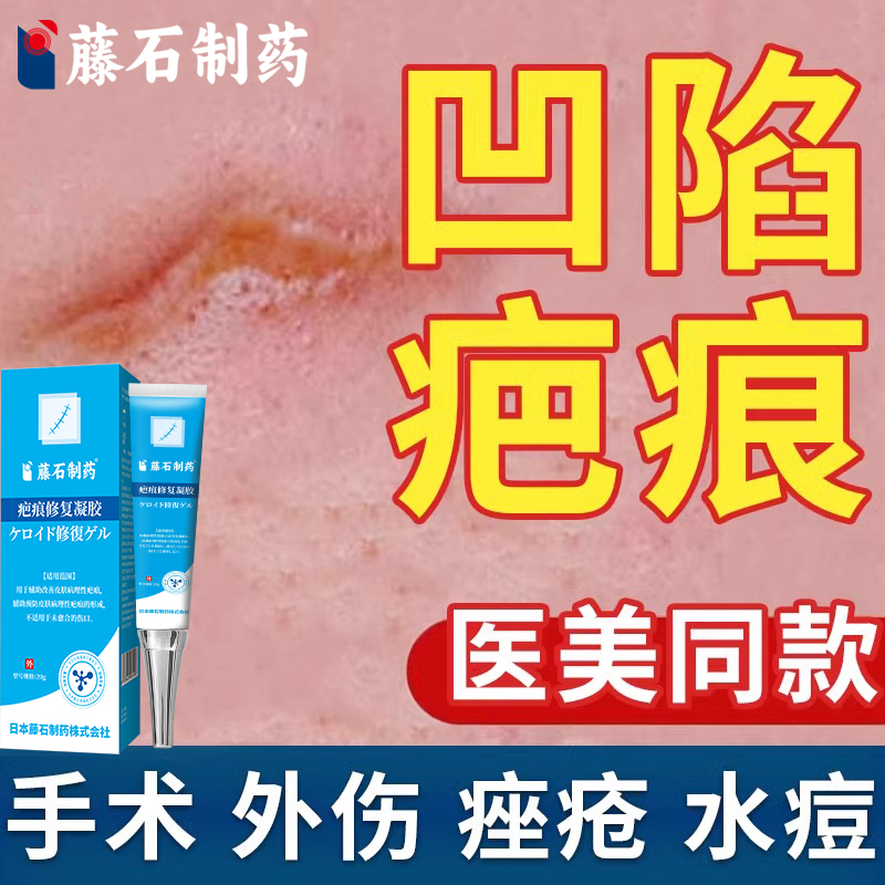 凹陷性疤痕修复除疤膏生长因子再生填充膏男女去祛痘坑凹凸凹洞WQ