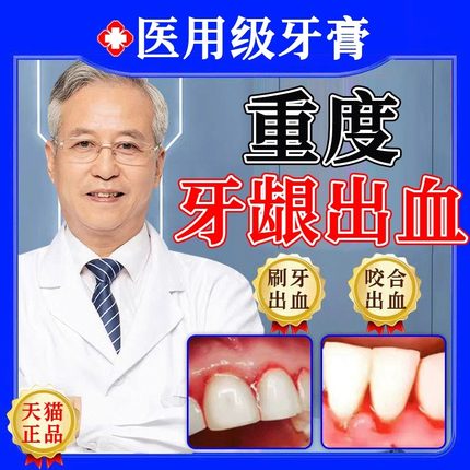 云南白药牙膏牙周炎牙龈出血专用正品护龈止痛双效抗敏官方旗舰FF