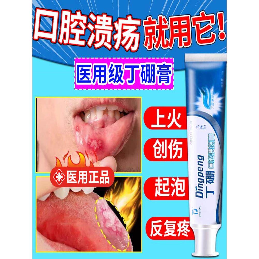 口腔溃疡专用牙膏美克舒益生菌维生素专口腔上火嘴巴舌头烂YX