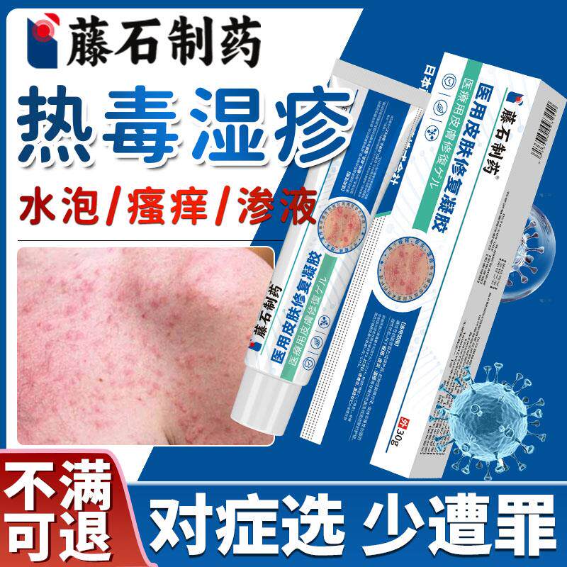 热毒湿疹止痒膏血热型皮肤瘙痒热疹湿毒清软膏祛湿痒根药房同售DS