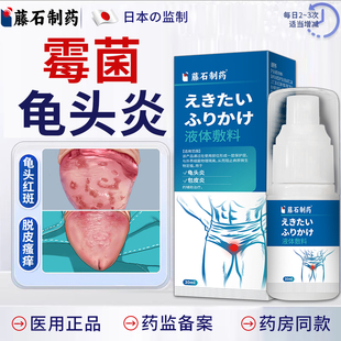 霉菌性龟头炎红点包皮发炎豆腐渣白垢喷剂专用男私处真菌感染症ZM