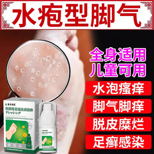 藤石制药水疱型脚气脚起小水泡又痒又脱皮汗疱疹喷雾去止痒根膏TU