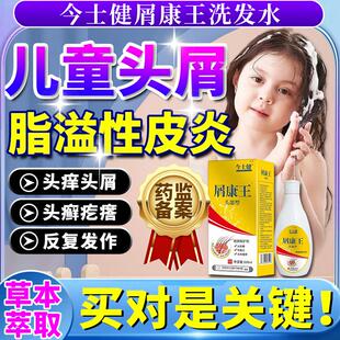 儿童头皮真菌感染洗发水止痒头屑头痒喷雾脂溢性皮炎头癣银屑癣EW