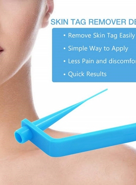 不疼 肉赘去肉粒神器脖子肉粒猴子肉痣s状疣tagband胶圈皮赘器