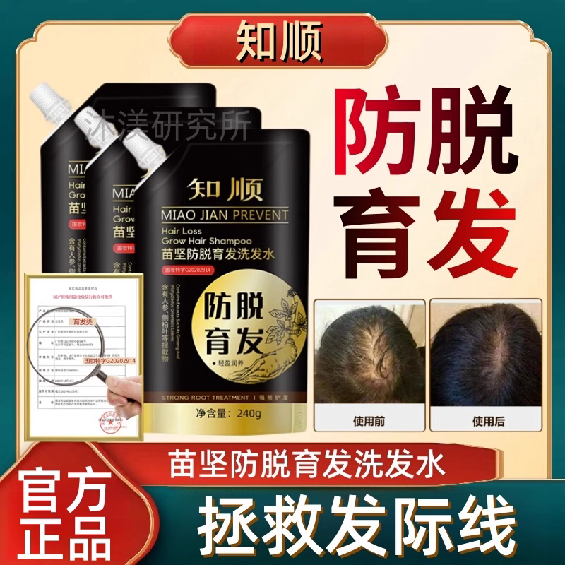 知顺防脱育发洗发水官方去屑止痒生发滋养维稳蓬松男女官网正品