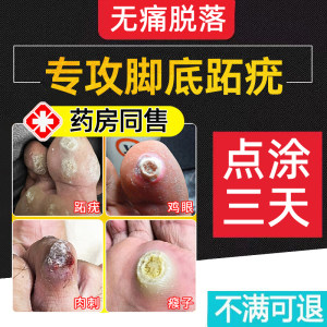 【北京恊和】跖疣专用膏药房同售