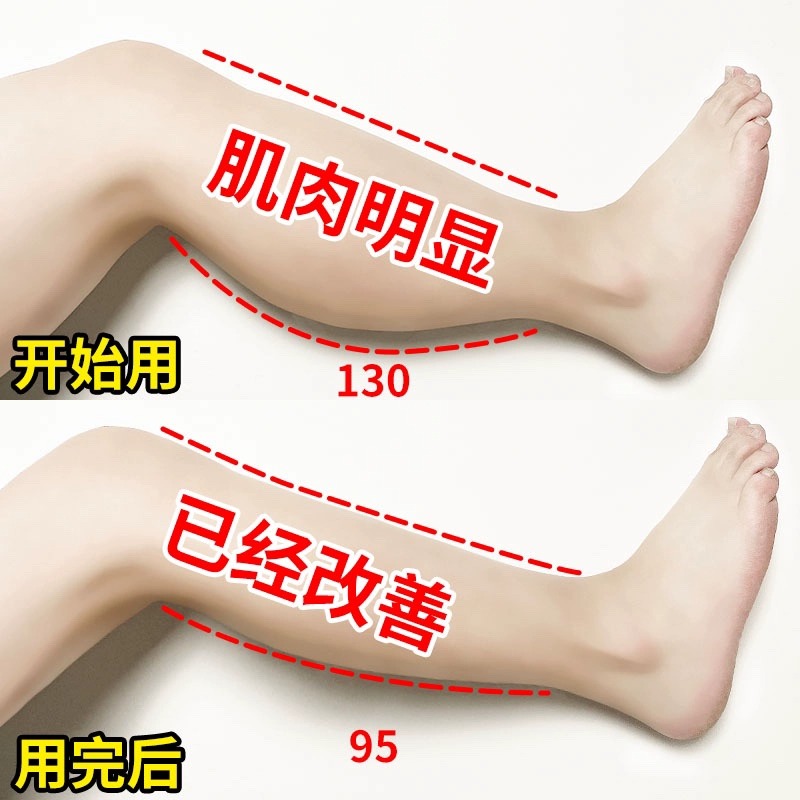 音魅瘦腿神器瘦小腿肌肉按摩器腿部按摩仪静脉腿粗曲张消除足疗机