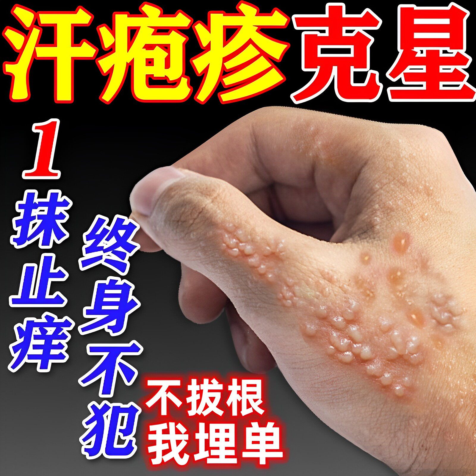 汗泡疱疹药膏汉状真菌感染手气膏手上起小水泡干裂手痒脱皮专用膏
