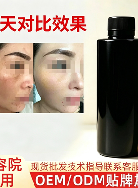 美容院强效代谢排色液脱皮液