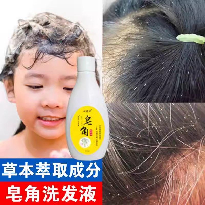屈臣氏剪发虫洗发水男女士专用正品天然皂角液去屑止痒除螨控油