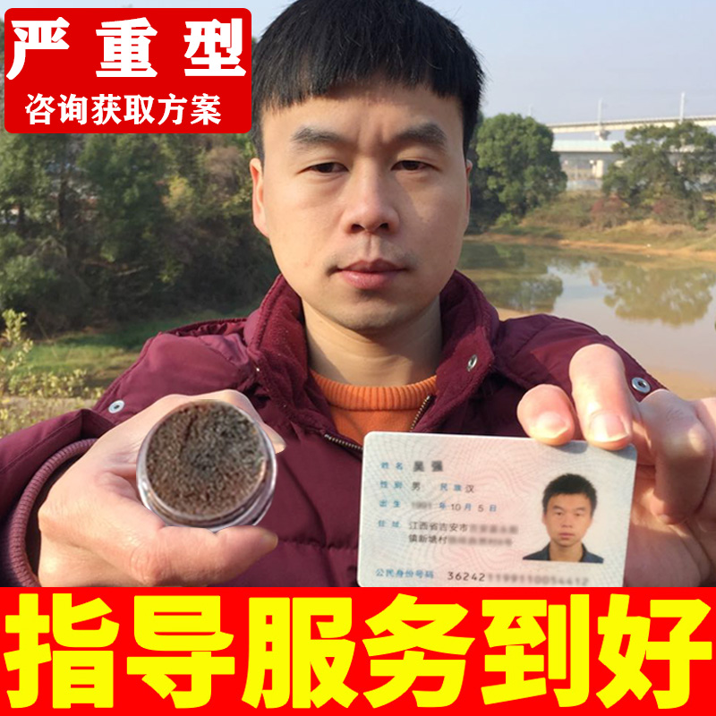 雞眼膏雞尤康雞繭眼膏老繭眼貼腳趾凈腳底平靈腳上手足部抑菌液去