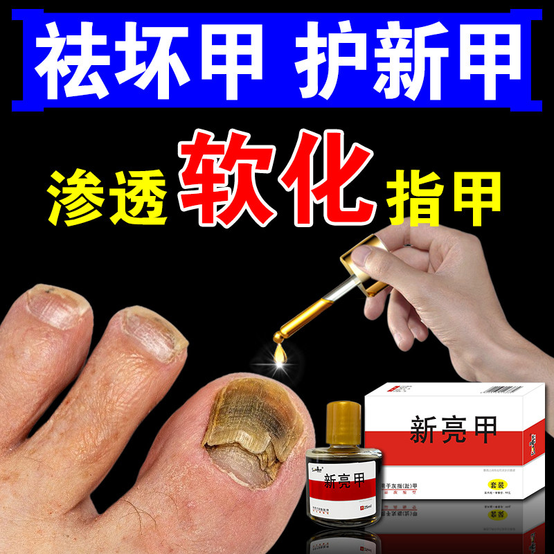 灰指甲抑菌液专用药正品脱甲膏精油冰醋酸30灰指甲抗菌脚指甲增厚