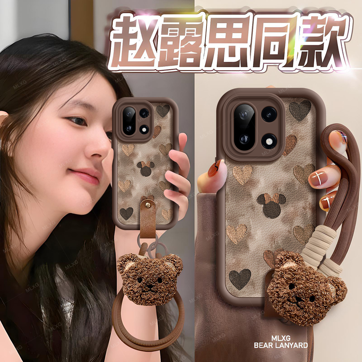 适用OnePlus15手机壳卡通皮纹