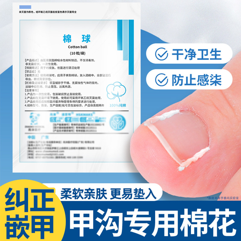 甲沟塞棉花指甲矫正器脚趾甲卷甲纠正工具不扎肉填充隔离垫片神器