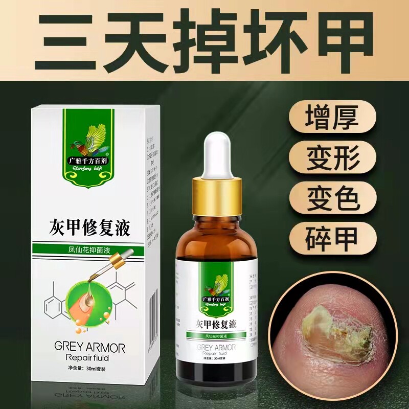 灰指甲抑菌液消肿去除增厚灰甲净冰醋酸软甲膏灰指甲治疗专用药