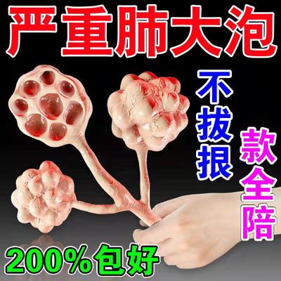 肺大泡特效药治肺气肿哮喘胸闷气短呼吸不畅专用药慢阻肺止咳贴