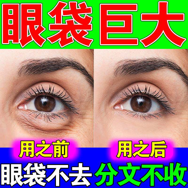 去眼袋药膏祛除神器男士专用淡化细纹黑眼圈消黑色素眼皮下垂克星