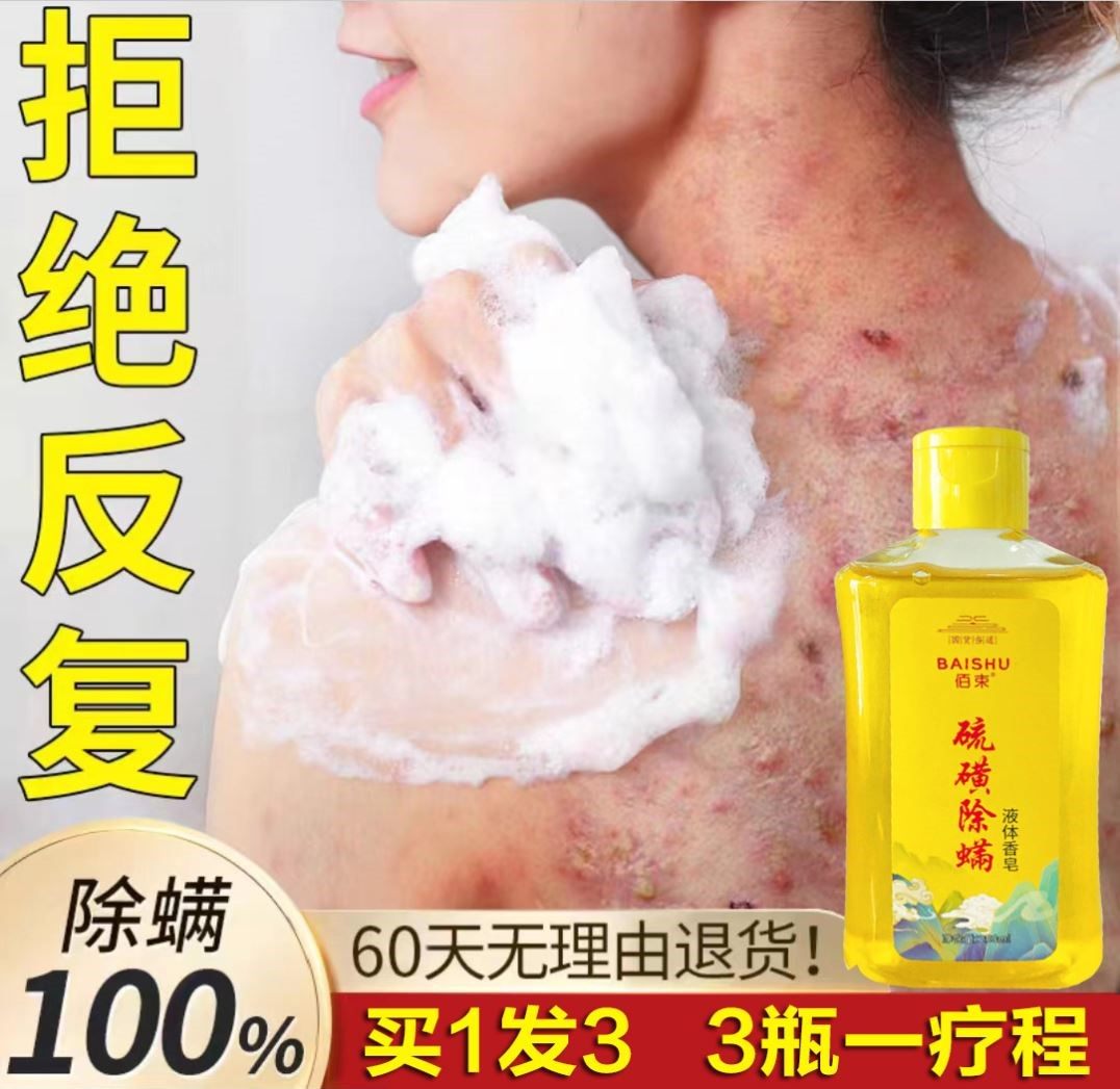 硫磺膏可以去鸡皮疙瘩吗(硫磺膏可以去鸡皮疙瘩吗图片)