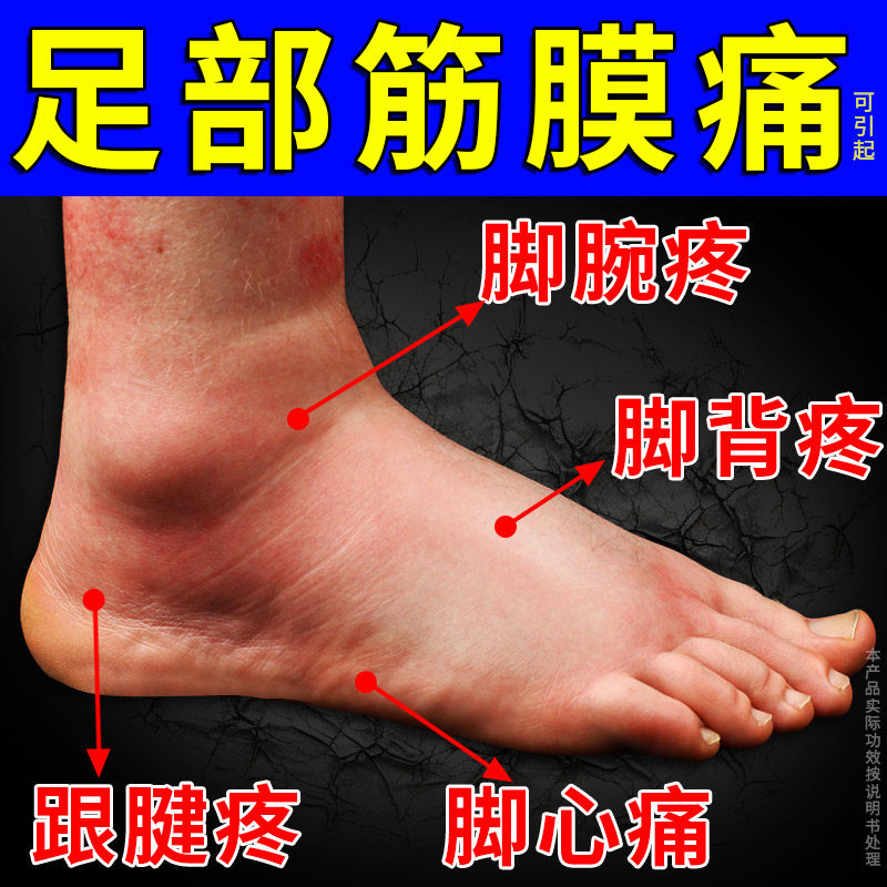 足底足跟痛贴引起足部筋膜炎脚背脚面脚跟脚心跟腱疼痛膏贴正品