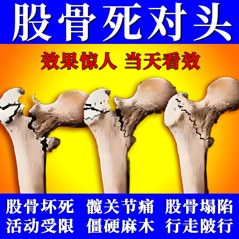 股骨头坏死专用疼痛治胯髋关节膏药贴塌陷再生中药康复理疗仪