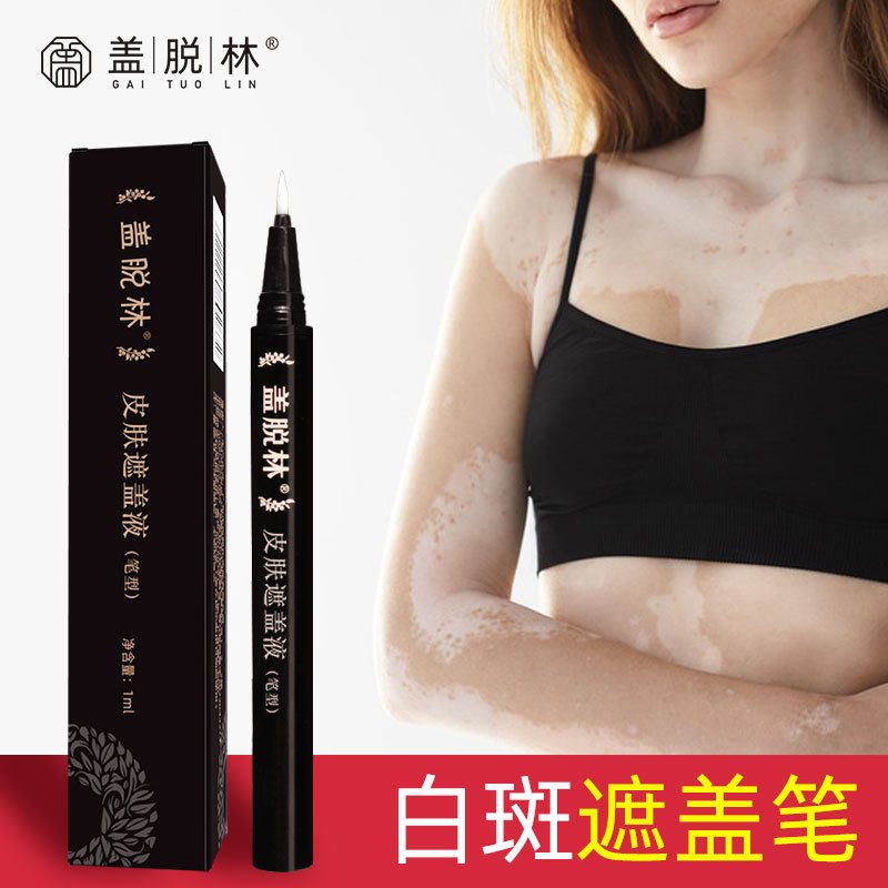 盖脱林白斑遮盖液遮瑕膏防水跨境外贸白班遮瑕液遮盖笔白斑