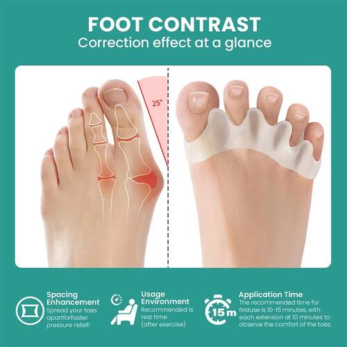 1 Pair Silicone Toe Separator Bunion Corrector Hammer Toe Co