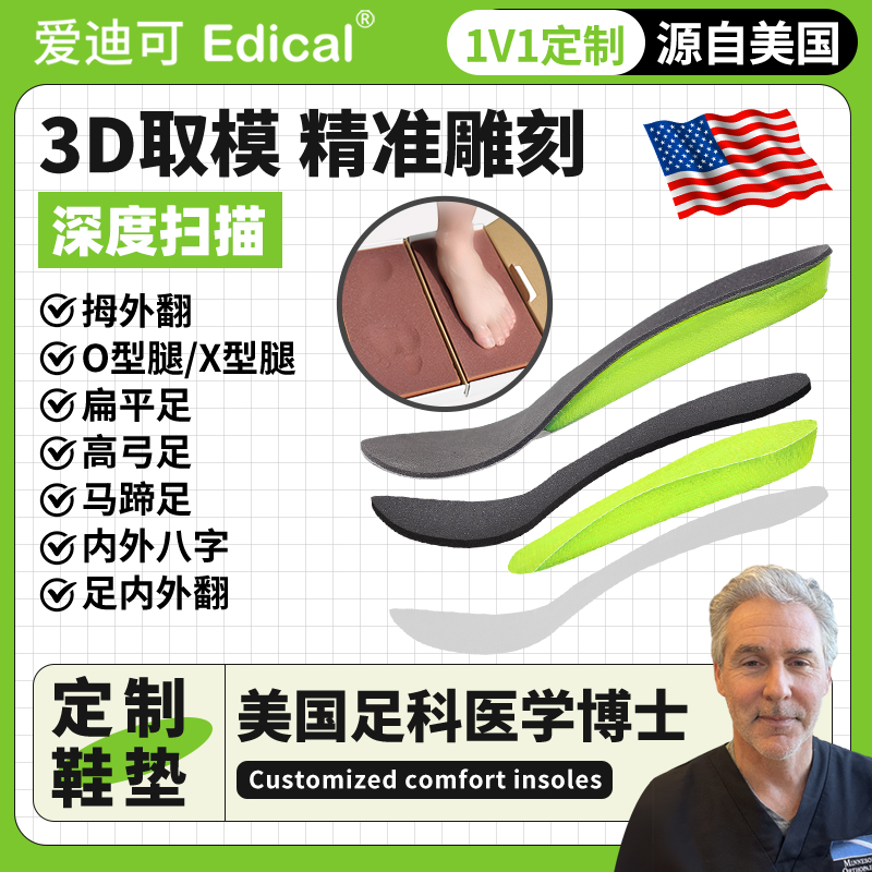 3D打印定制扁平足拇外翻矫正鞋垫
