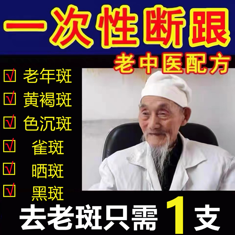 祛斑霜祛黄褐班老年斑去雀斑官方正品手部脸部手背专用药强力去除