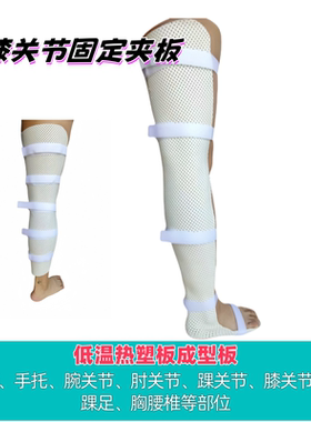 骨科低温热塑板腕肘骨折塑型固定