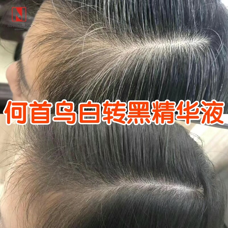 何首乌白转黑精华液白发转黑发生头发营养液护发防脱育发液乌发液