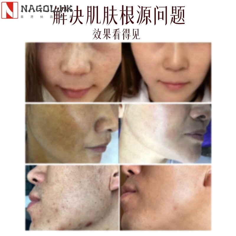 郁美净同款 灯泡肌提亮肤色改善暗沉亮肤美肌素颜无尴尬期精华液