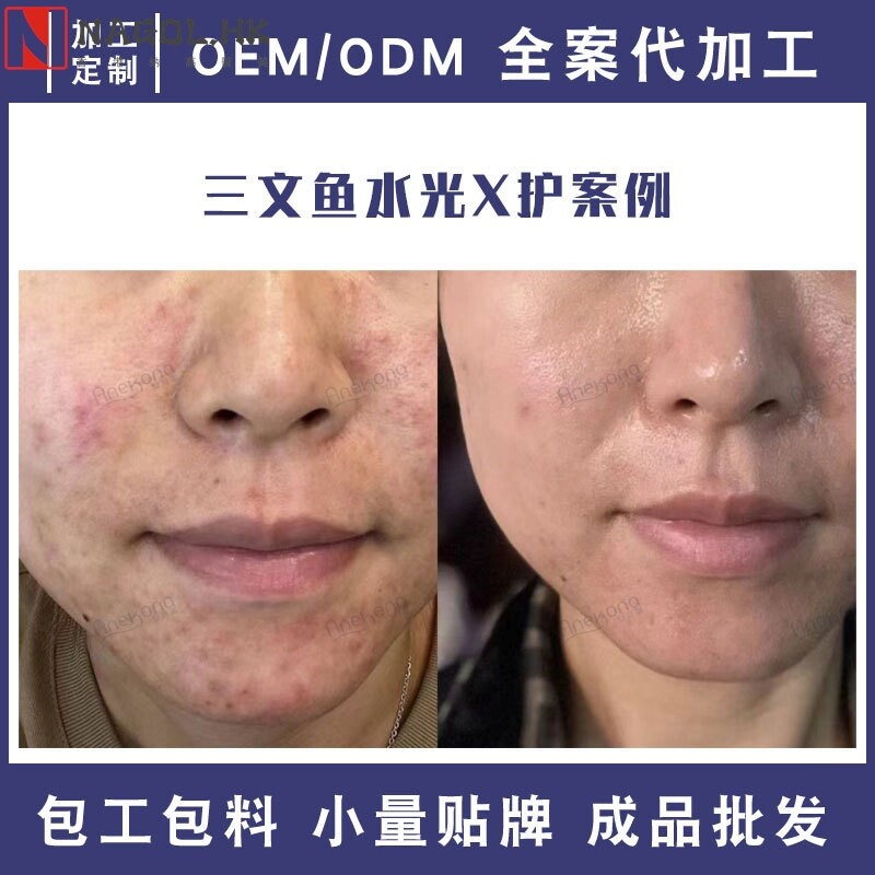 美容院补水嫩肤修护水光原液套盒 深导DNA钠婴儿肌PDRN三文鱼水光