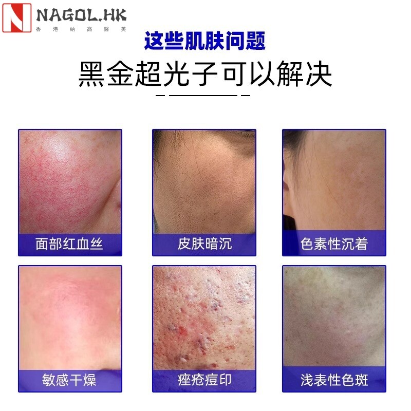DPL黑金牛奶光嫩肤仪面部清洁淡化痘印提亮超光子美容院专用仪器