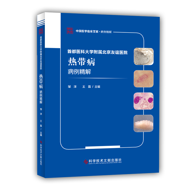 首都医科大学附属北京友谊医院热带病病例精解