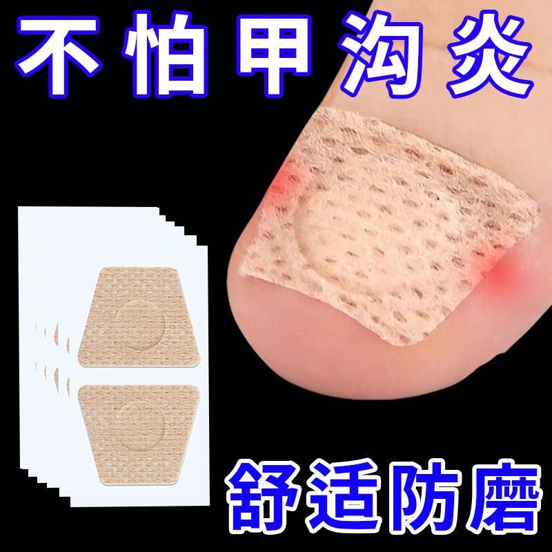 指甲护理贴片嵌甲甲沟往肉里长脚趾垫矫形贴软甲灰指甲修护贴
