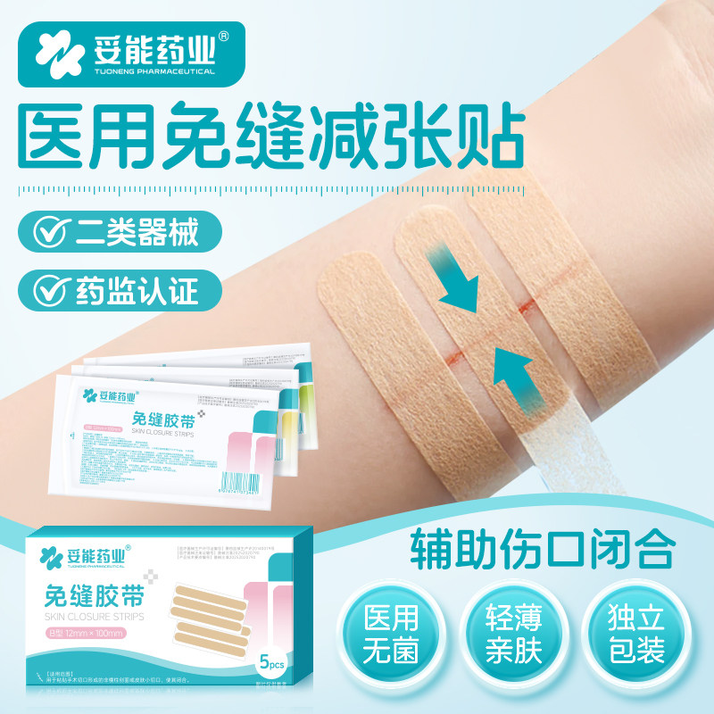 妥能医用减张贴术后伤口愈合