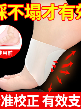 足弓垫贴横弓塌陷脚弓矫正器鞋垫拇外翻拖鞋高跟鞋支撑扁平足训练