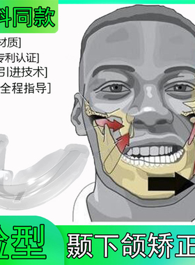 大小脸偏颌颞下颌关节紊乱矫正器下巴歪咬合异常弹响颌垫TMJ夜用