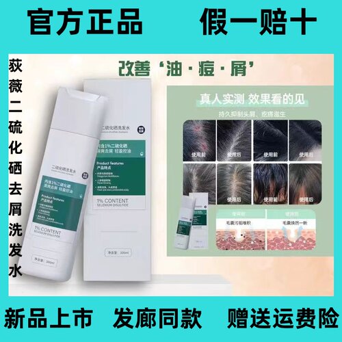 荻薇去屑止痒通用好用