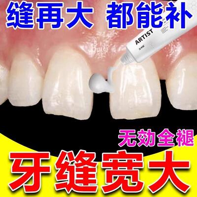 牙缝宽大修复神器补牙缝牙膏填充门牙牙缝大矫正防堵蛀牙牙洞清理