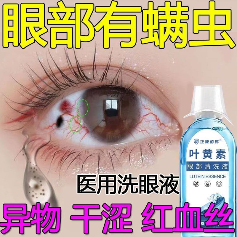 洗眼液清洁抗菌眼睛迎风流泪模糊干涩洗缓解红血丝异物止痒去