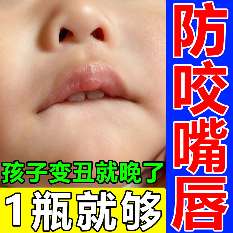 防咬下嘴唇神器宝宝纠正器戒咬嘴唇改善小孩子口呼吸矫正前庭盾贴