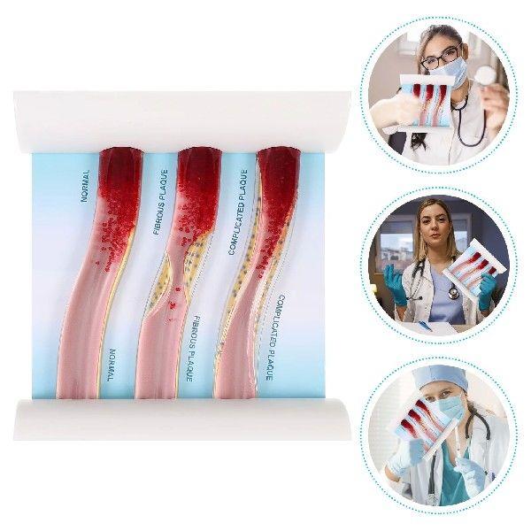 Model Dynamicanatomical Teaching Ldl Vascular Blood Vessel