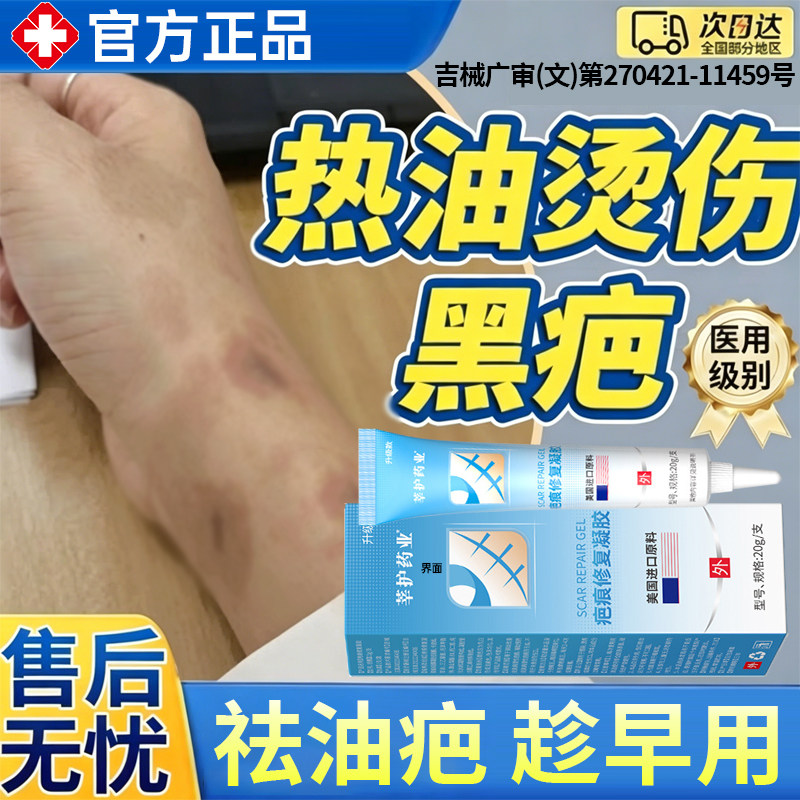 热油烫伤烧伤去疤膏疤痕修复除疤膏去疤印增生凸起术后疤痕疙瘩YB