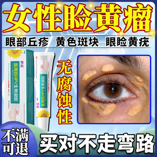 眼睑黄瘤去眼皮黄斑瘤专用膏眼部脂肪粒睑黄疣眼角黄斑去除神器WY