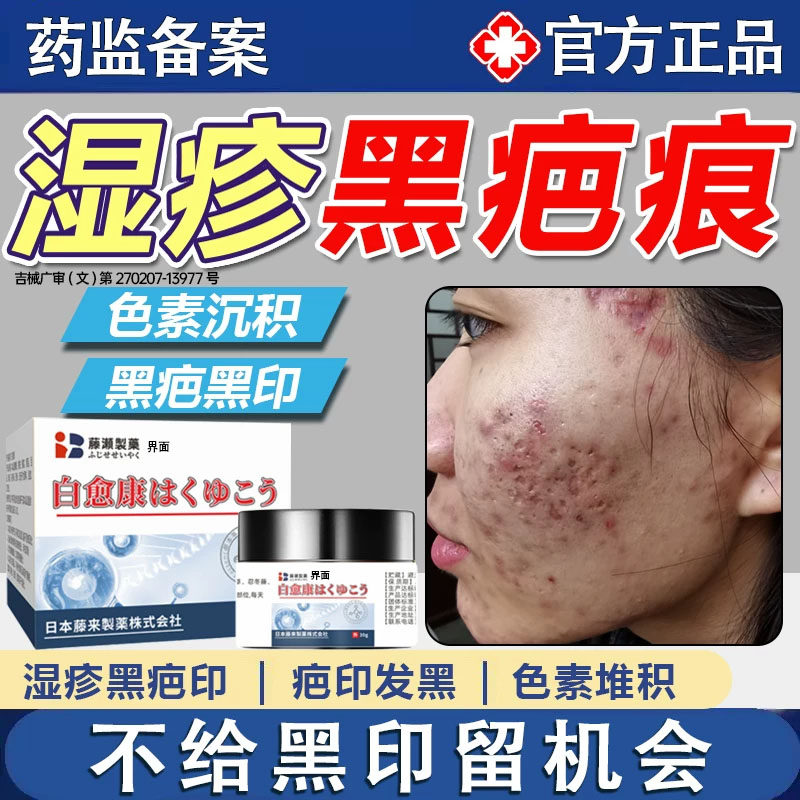 湿疹疤痕黑色素沉淀去黑印淡化祛疤膏腿上脸后背痘印黑棘皮药膏FY
