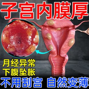 子宫内膜厚的药调理增厚月经淋漓不尽止血药异位症贴膏修复息肉LL